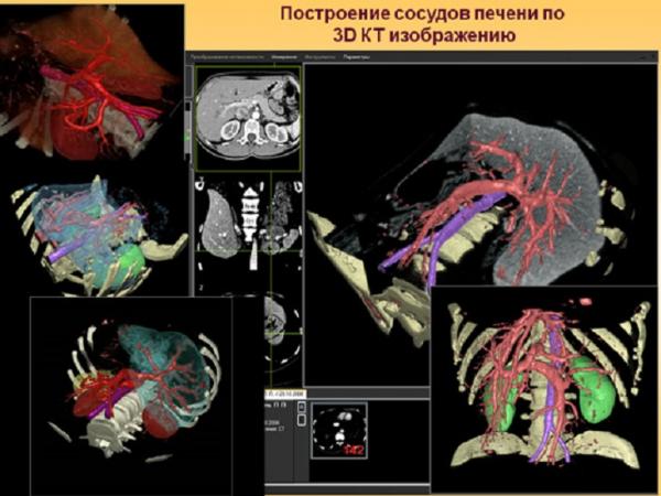 Математика помогает создать модели той или иной системы человеческого организма, чтобы потом «протестировать» на них лекарственные препараты