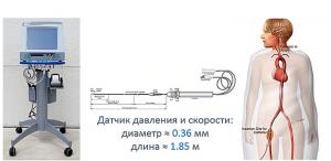 Измерение давления и скорости кровотока