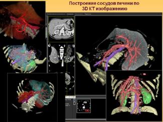 Математика помогает создать модели той или иной системы человеческого организма, чтобы потом «протестировать» на них лекарственные препараты
